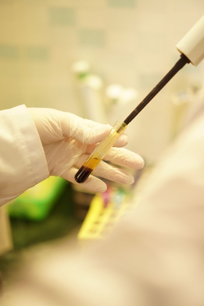 our-story Close-up of a scientist's gloved hand holding a test tube with blood sample in lab setting.