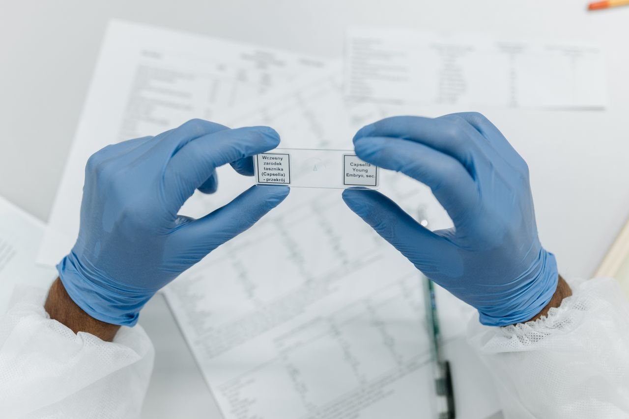 Mastering the First Impression: Your intriguing post title goes here Researcher holds labeled microscope slides wearing blue gloves, in a laboratory setting.