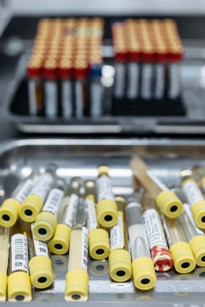 services-03 Close-up image of blood samples in test tubes at a laboratory, showcasing medical analysis equipment.